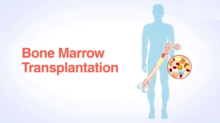 Bone marrow transplant in india