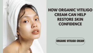 Organic vitiligo cream